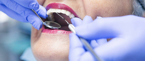 Best Urgent Tooth Repair  in Pine Mountain Lake, CA